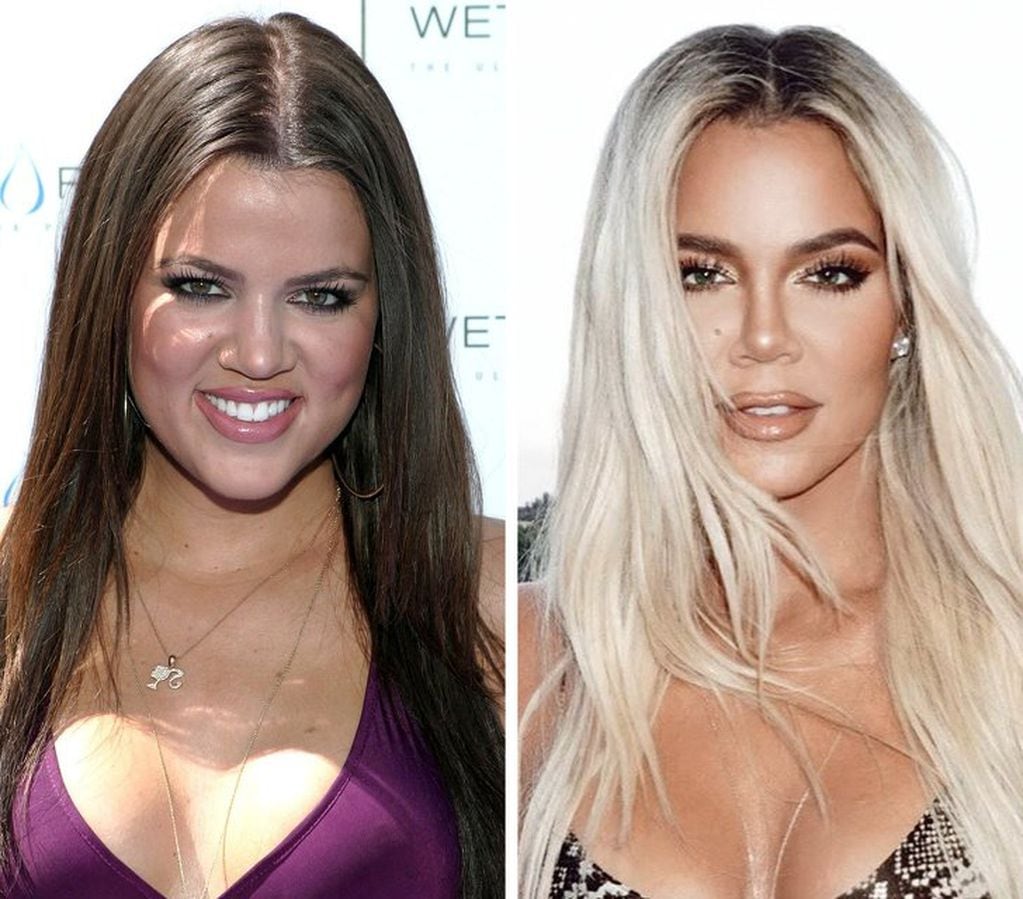 El antes y el después de Khloé Kardashian. Gentileza: Elle