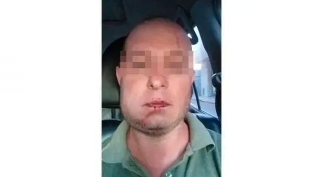 Oscar Galíndez, hombre atacado por policías en Río Cuarto