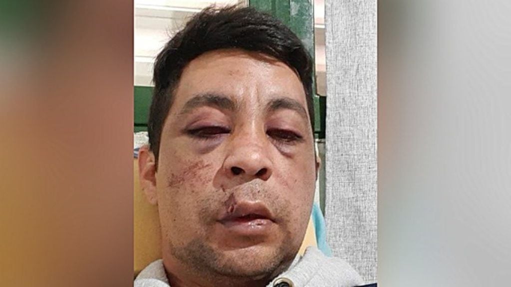 Un enfermero recuperado de coronavirus fue golpeado por vecinos y le incendiaron su casa en Neuquén
