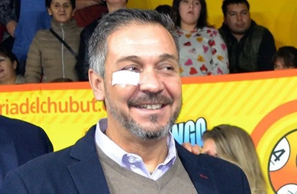 Barbato el domingo pasado en Corcovado, con un apósito en su ojo derecho.