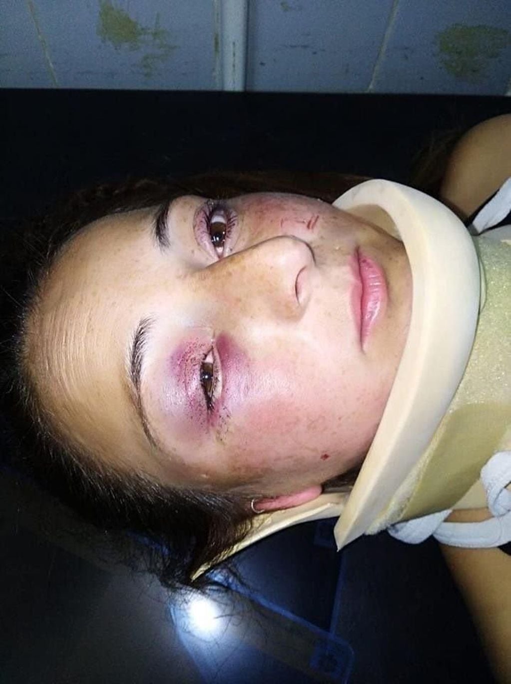 "Trate de defenderme pero no pude", comentó la joven agredida por una boxeadora en La Plata