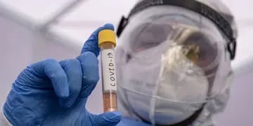 Estudios en monos sugieren que las personas que tuvieron coronavirus estarían “protegidas” para futuras infecciones Web