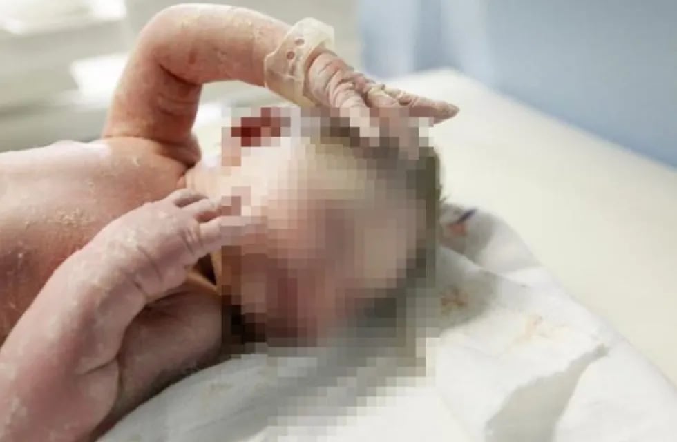 Rodrigo, el bebé que nació sin rostro, ya habla. (Web)
