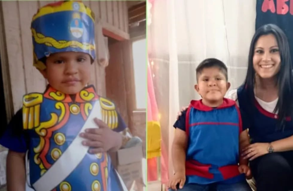 Matías Ríos, el salteño de 5 años que necesita dos implantes.