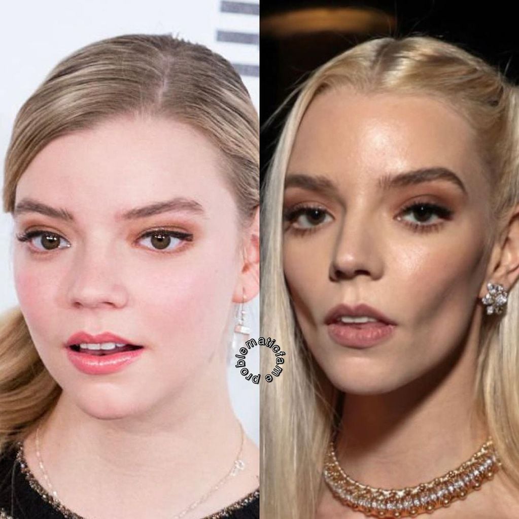 Un usuario de Instagram comparó el rostro de Anya Taylor-Joy en 2017 y ahora