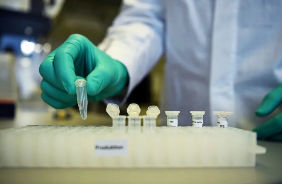 FILE PHOTO: An employee of German biopharmaceutical company CureVac, demonstrates research on a vaccine for the coronavirus (COVID-19) disease at a laboratory in Tuebingen, Germany, March 12, 2020. REUTERS/Andreas Gebert/File Photo