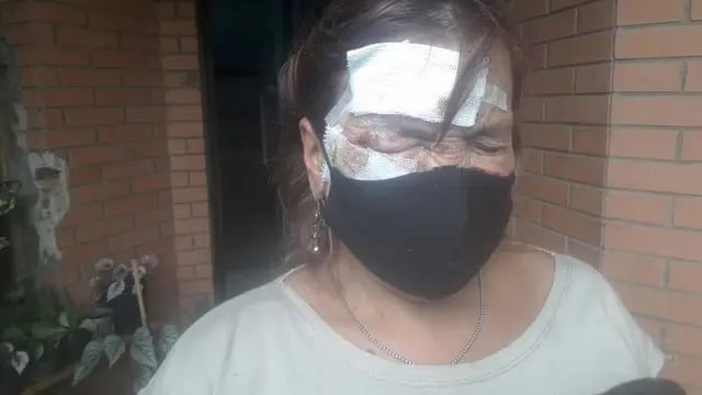 Mujer atacada a golpes en Concordia