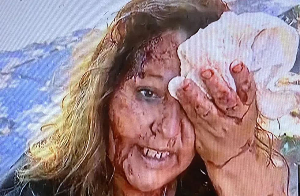 Mujer con el rostro destrozado por culatazos de delincuentes (Captura imagen TV)