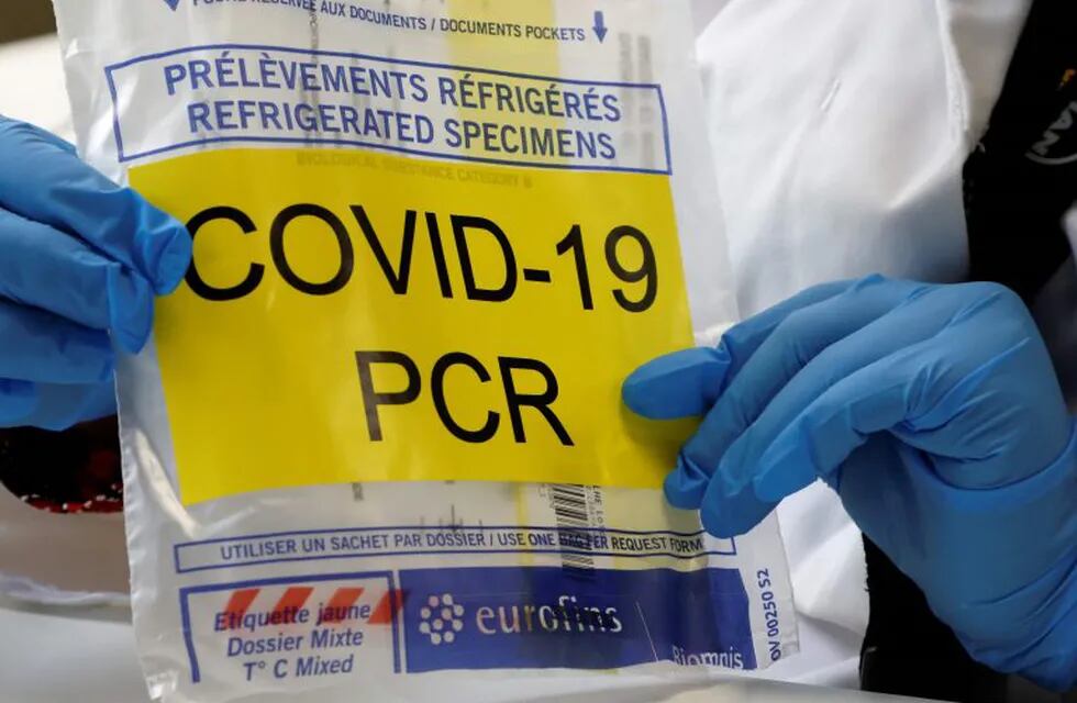 This picture taken on October 28, 2020, in the biosafety level 2 laboratory Biomnis in Ivry-sur-Seine, near Paris, shows a bag to transport test tube of a sample to be analysed with PCR method to detect the Covid-19 novel coronavirus. (Photo by Ludovic MARIN / AFP)