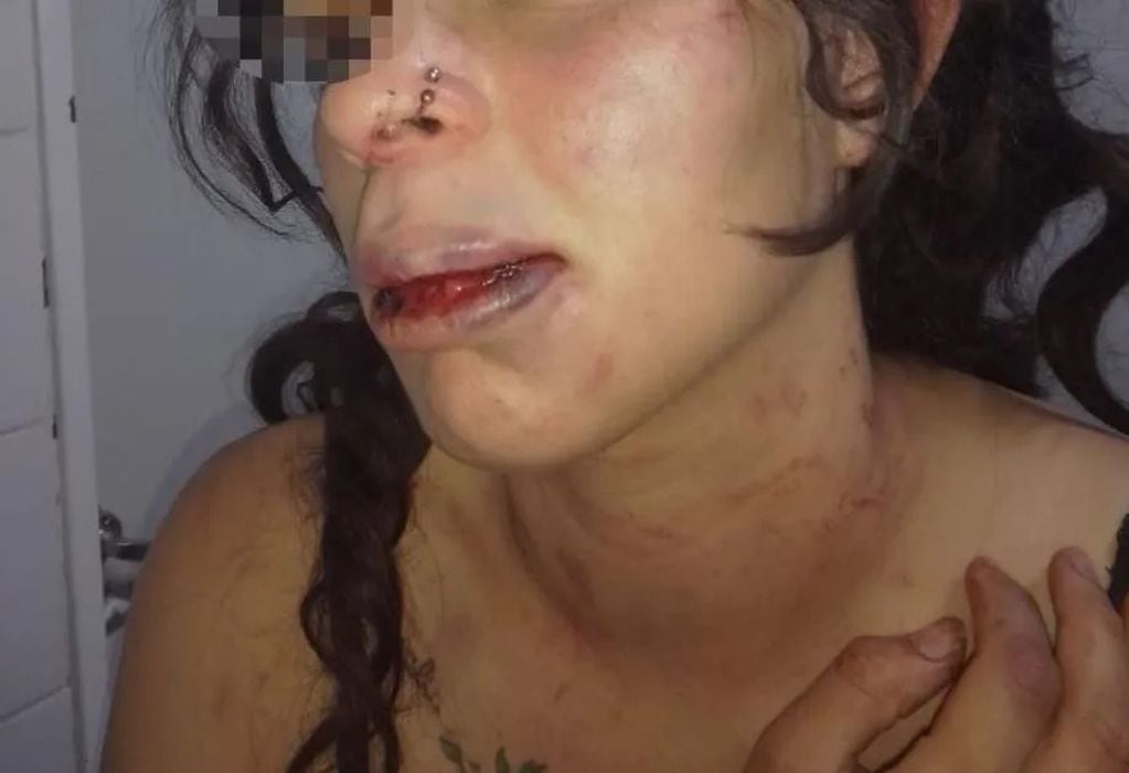 La mujer de 24 años fue brutalmente golpeada por su ex pareja delante de sus dos hijas.