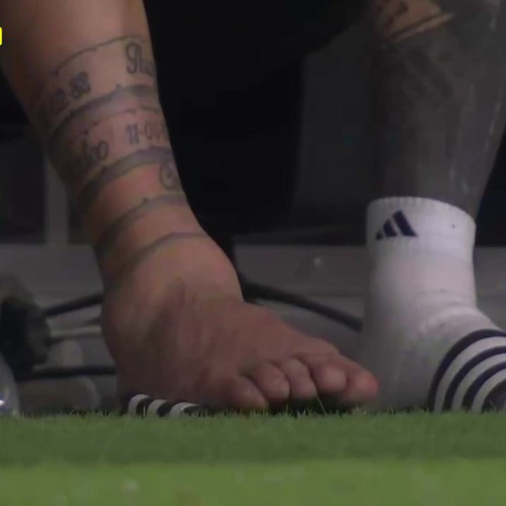 El tobillo de Lionel Messi