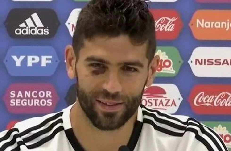 Federico Fazio ironizó sobre su ojo morado en plena conferencia de prensa antes de jugar ante Francia.