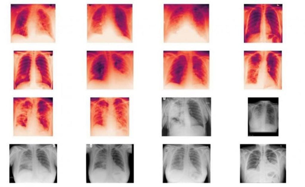 Detección de Covid-19 con Radiografías.
