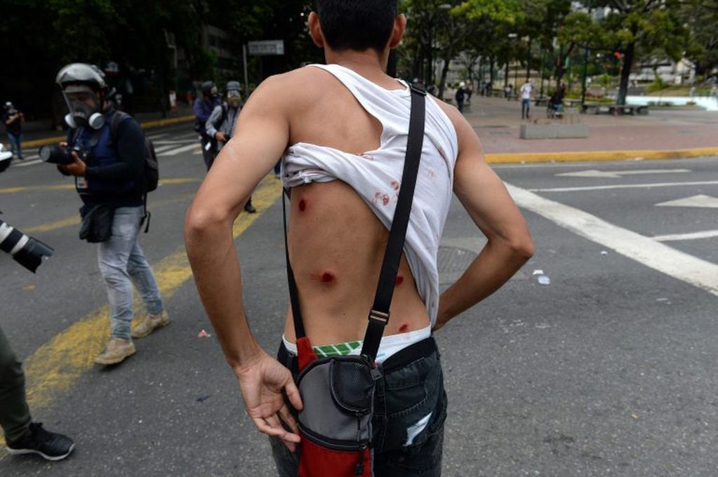 Un herido por los disturbios en Venezuela. (AFP)