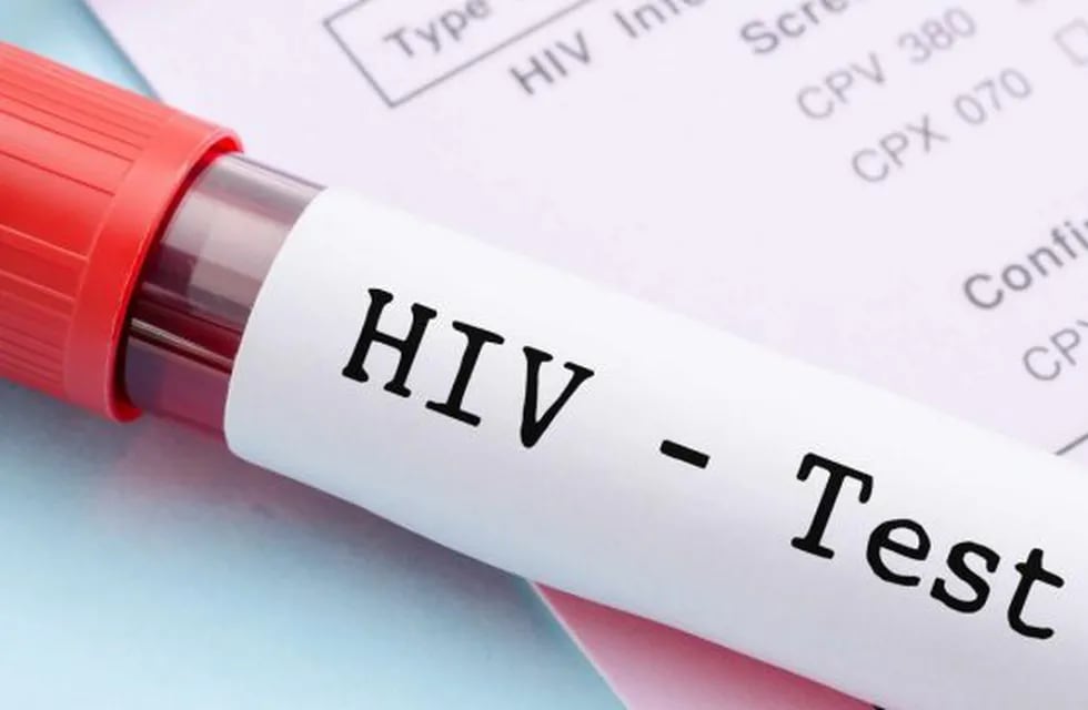 Una oportunidad de tomar conciencia sobre el VIH SIDA.