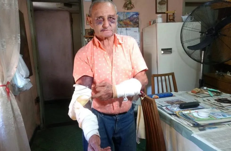 Abuelo de 74 años fue atacado salvajemente el domingo en su vivienda.