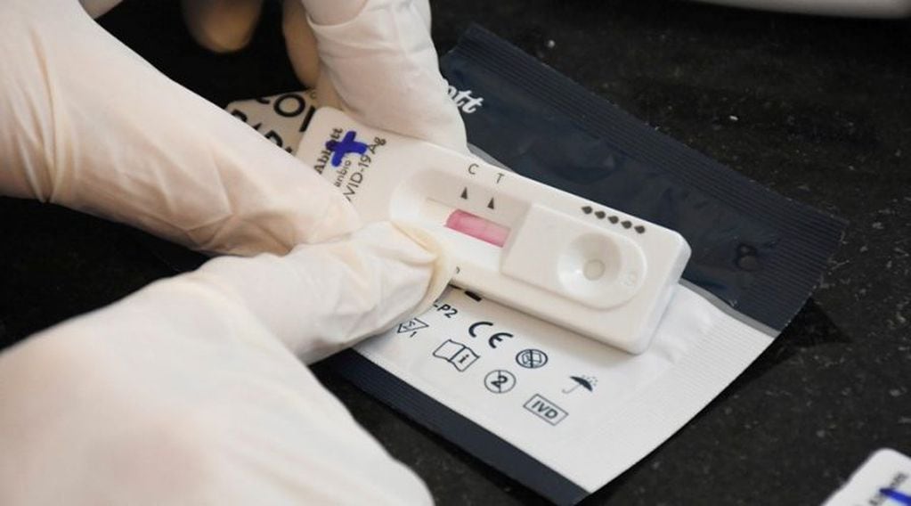 El test es rápido y económico pero no reemplaza a la PCR, que es el método gold standard (APN)