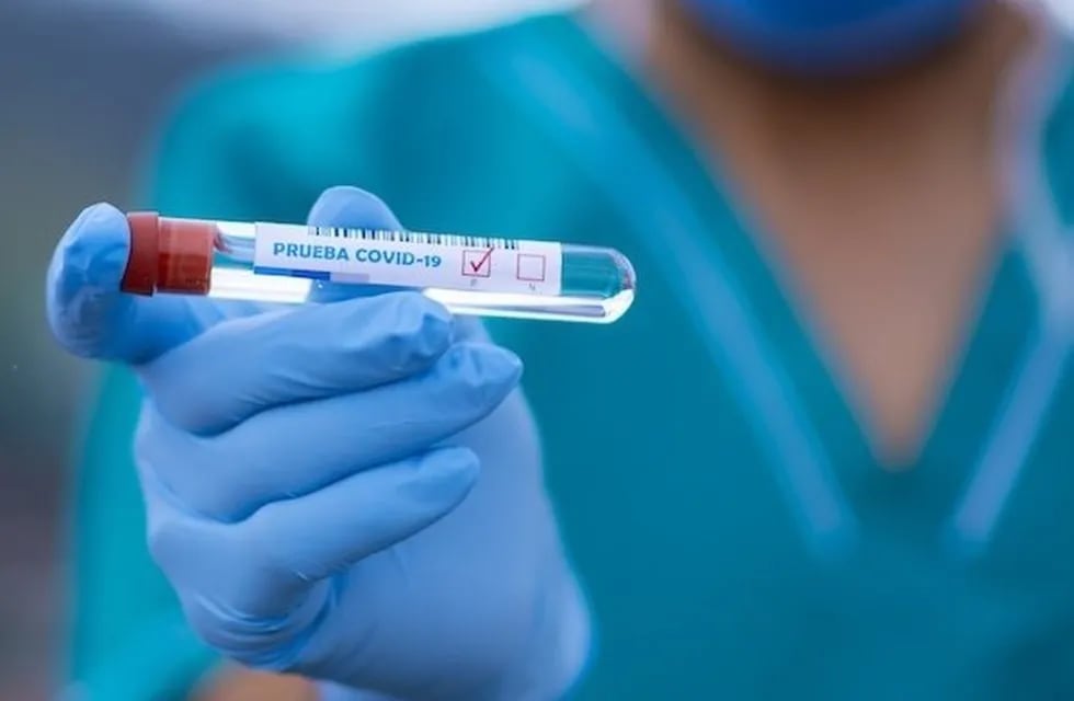 Pruebas de PCR. (dpa)