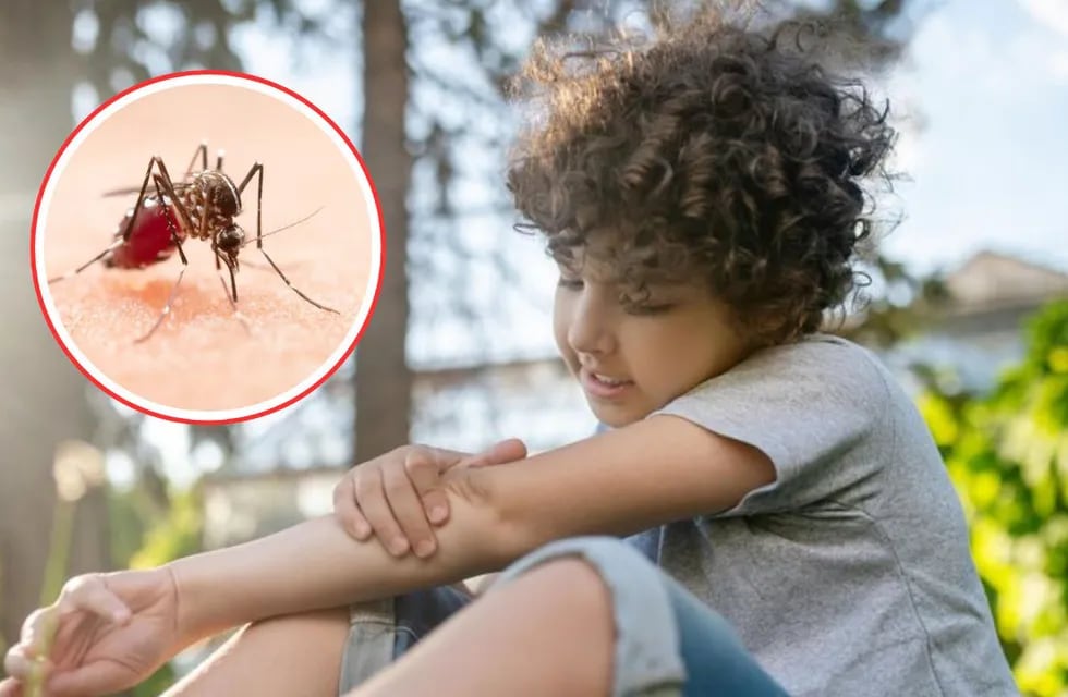 Dengue en niños: cuáles son los síntomas y qué hacer si mi hijo tiene.