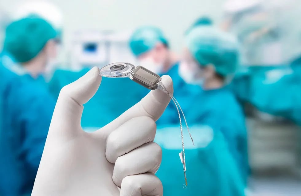 El Servicio de Otorrinolaringología del Hospital Luis Lagomaggiore realizó el primer implante coclear en adultos.