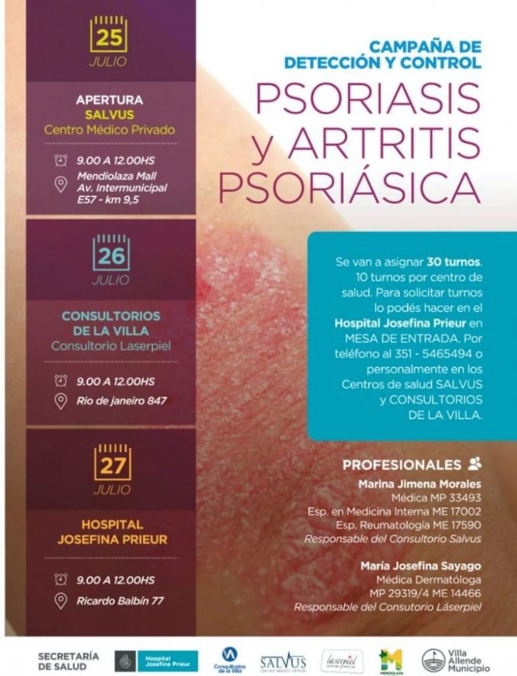 Campaña de detección y control de la psoriasis