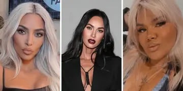 Qué es la bichectomía, el retoque estético de Kim Kardashian, Megan Fox y More Rial para lucir un rostro más delgado.