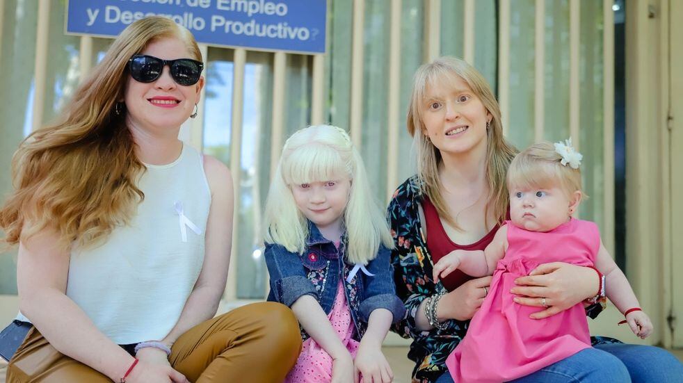 En la provincia hay una agrupación que nuclea a personas con albinismo y está a cargo de María Luz Ozollo