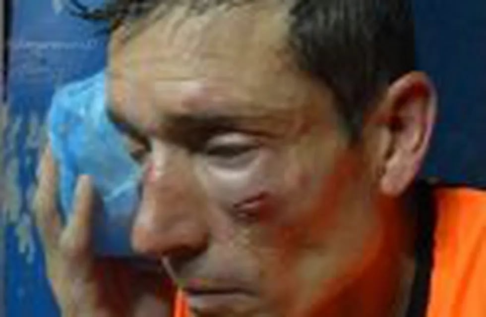 Así quedó el rostro de Claudio Elichiri, el u00e1rbitro agredido en Sarmiento de Ayacucho - Sansinena en el Federal B.
