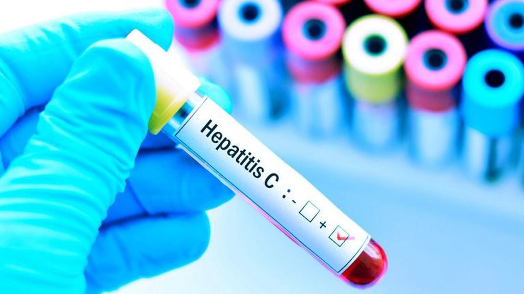 Hepatitis testeo