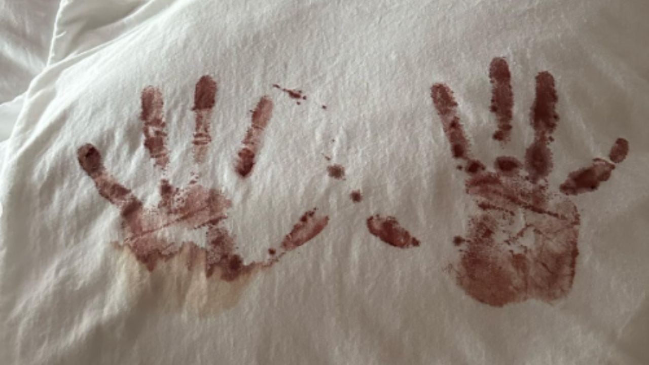 Las marcas de las manos de Camilo tras el nacimiento de su segunda hija.