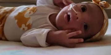 Bebé santiagueña que padece una extraña enfermedad