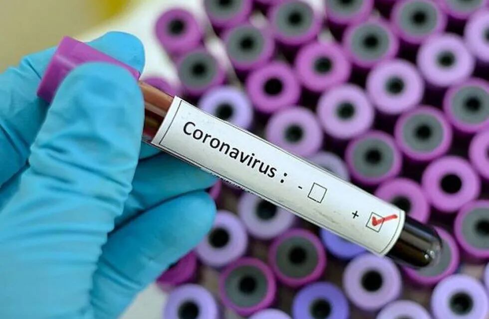 Coronavirus: De los 41 nuevos casos en el país, Chaco sumó 7