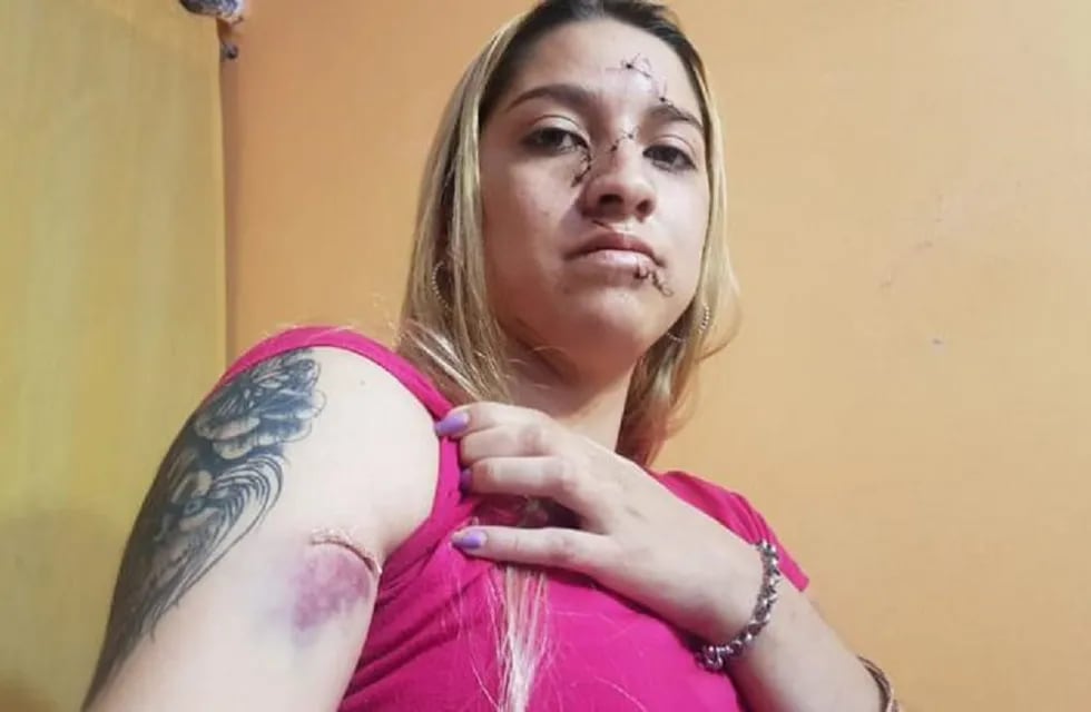 Melisa fue atacada por otras chicas con botellas rotas (foto, El Doce).