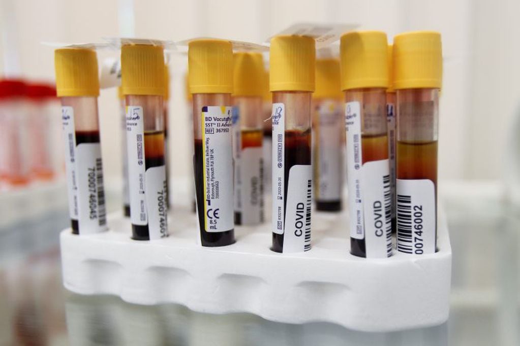 Testeo por coronavirus 
REUTERS/Maxim Shemetov