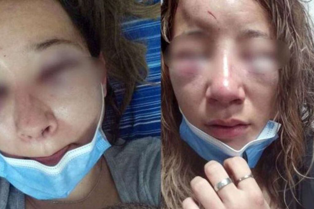 Una joven de 24 fue atacada brutalmente a la salida de un boliche por dos mujeres.