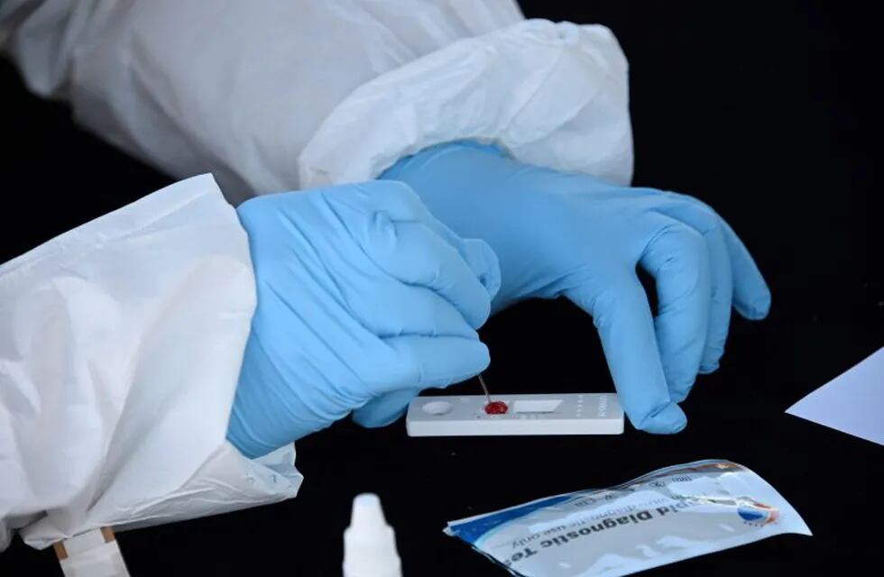 Test serológico para coronavirus. (AFP)