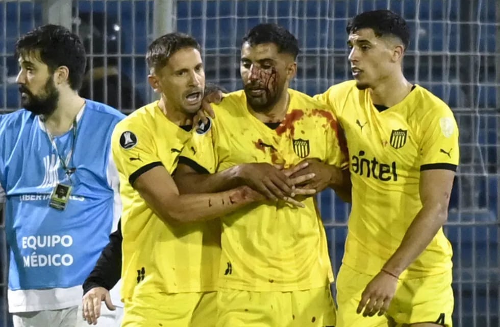 Un jugador de Peñarol fue herido por un proyectil