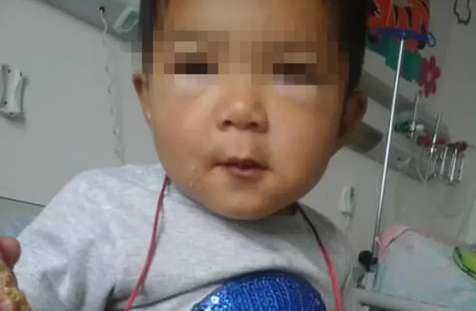 Matheo, el niño de 3 años, consiguió turno para operarse en Buenos Aires.