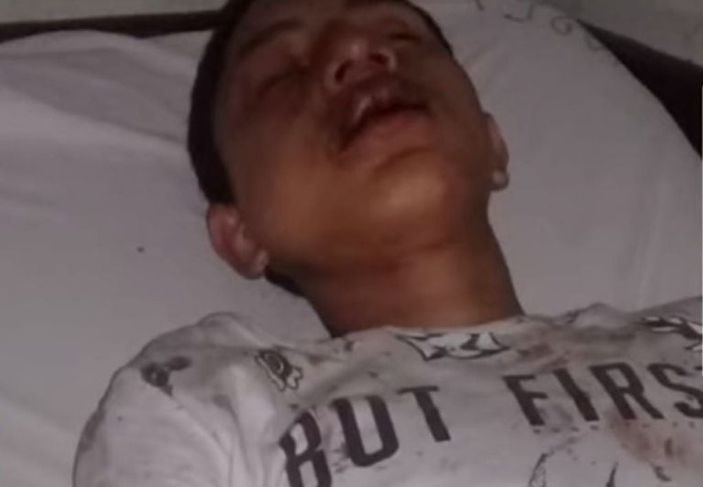 Julián Jonathan Correa tiene 15 años y fue salvajemente golpeado por una patota en Villa Gobernador Gálvez. (Captura de pantalla)