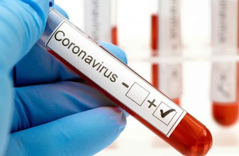 Coronavirus test.