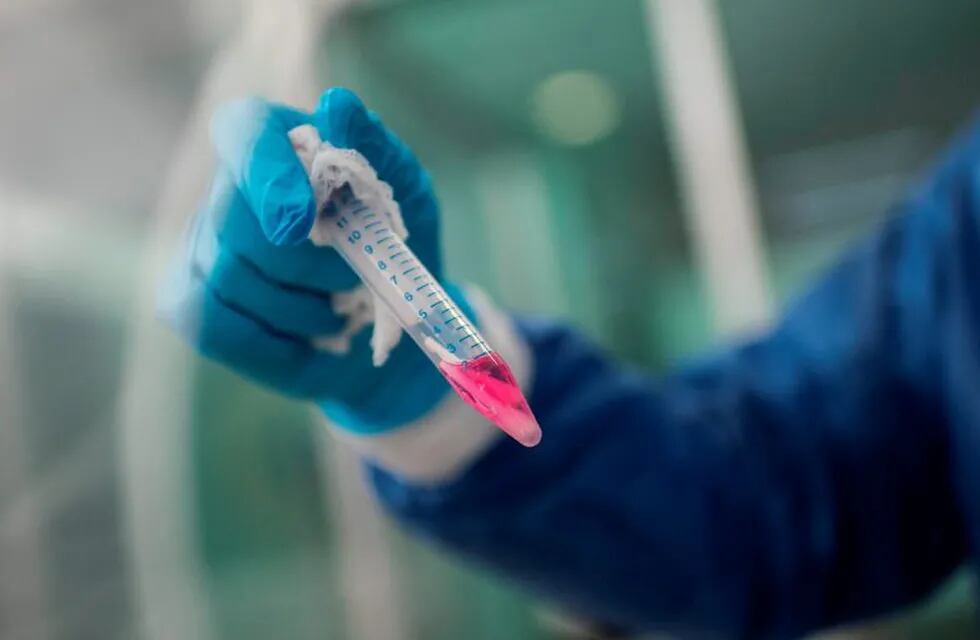 A health worker handles a swab sample from a patient tested for COVID-19 in Nezahualcoyotl, Mexico state on July 13, 2020 amid the coronavirus pandemic. - Mexico became on Sunday the fourth country with the most deaths in the world from the new coronavirus after overtaking Italy, according to an AFP report based on government sources. (Photo by PEDRO PARDO / AFP)   test pcr hisopo hisopado casos del dia