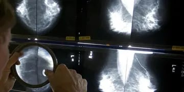 Mamografías. El estudio permite la detección precoz para evitar complicaciones y muertes.(La Voz / Archivo)
