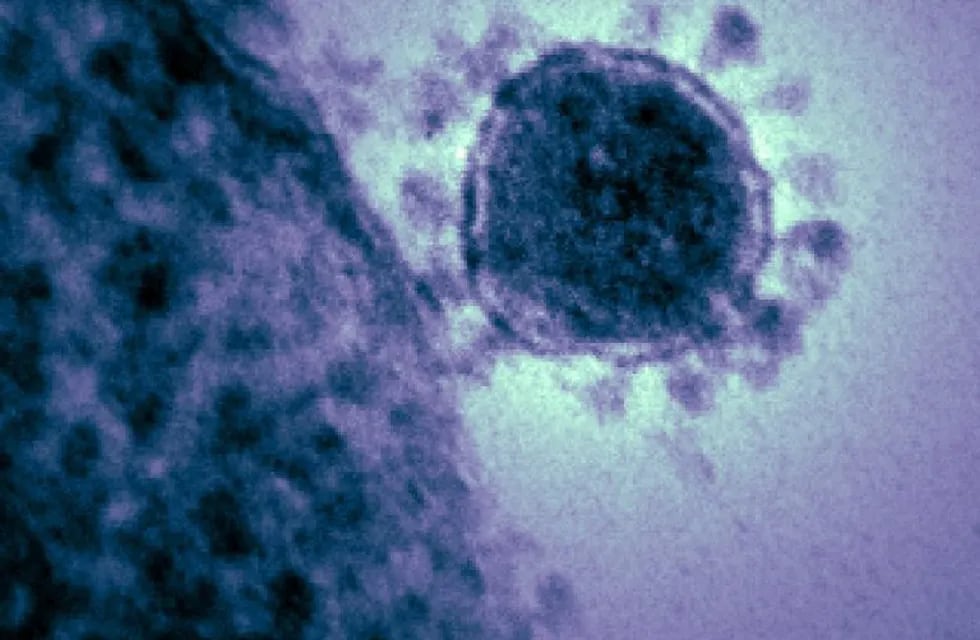 Imagen de archivo de un coronavirus