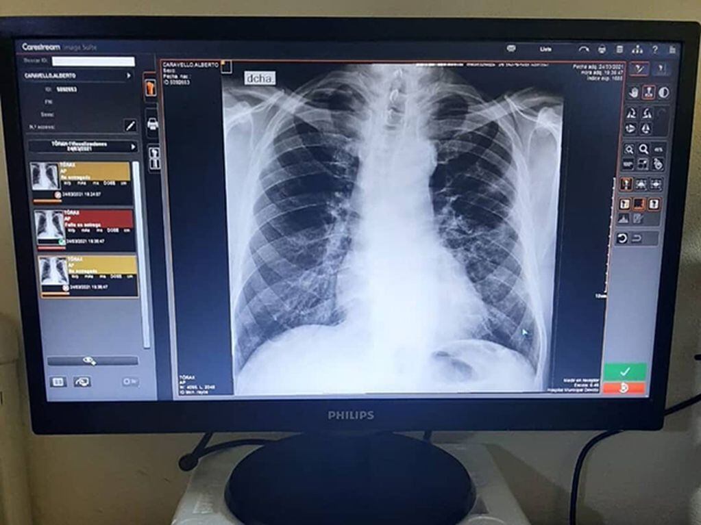 El dispositivo permite digitalizar las radiografías. (Foto: DevotoDigital)