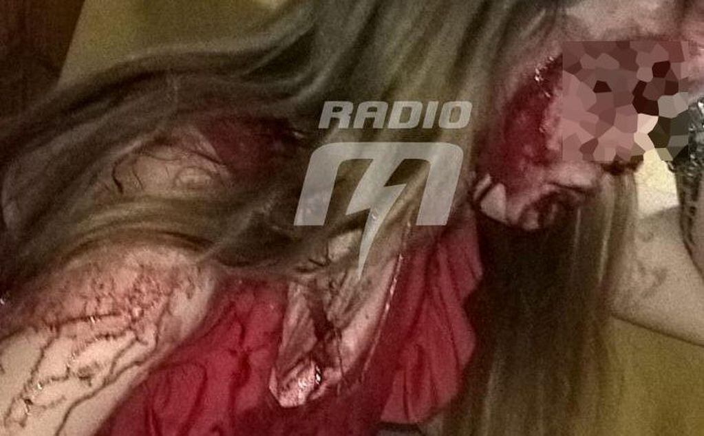La joven llegó a su casa bañada en sangre después del ataque. (Radio Eme)