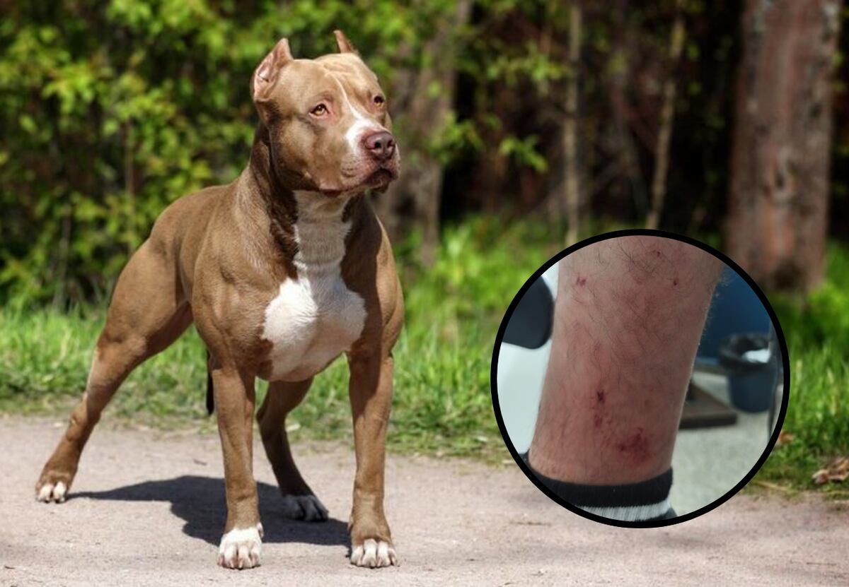 Insólito: soltó a dos pitbulls para atacar a policías en un operativo en Córdoba