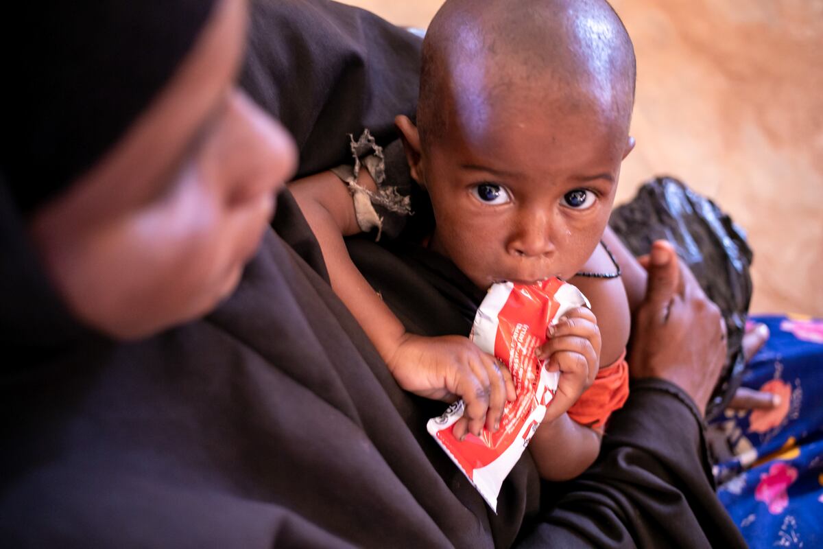 Qué es el ATLU, el alimento especial creado para combatir la desnutrición infantil y salvar vidas