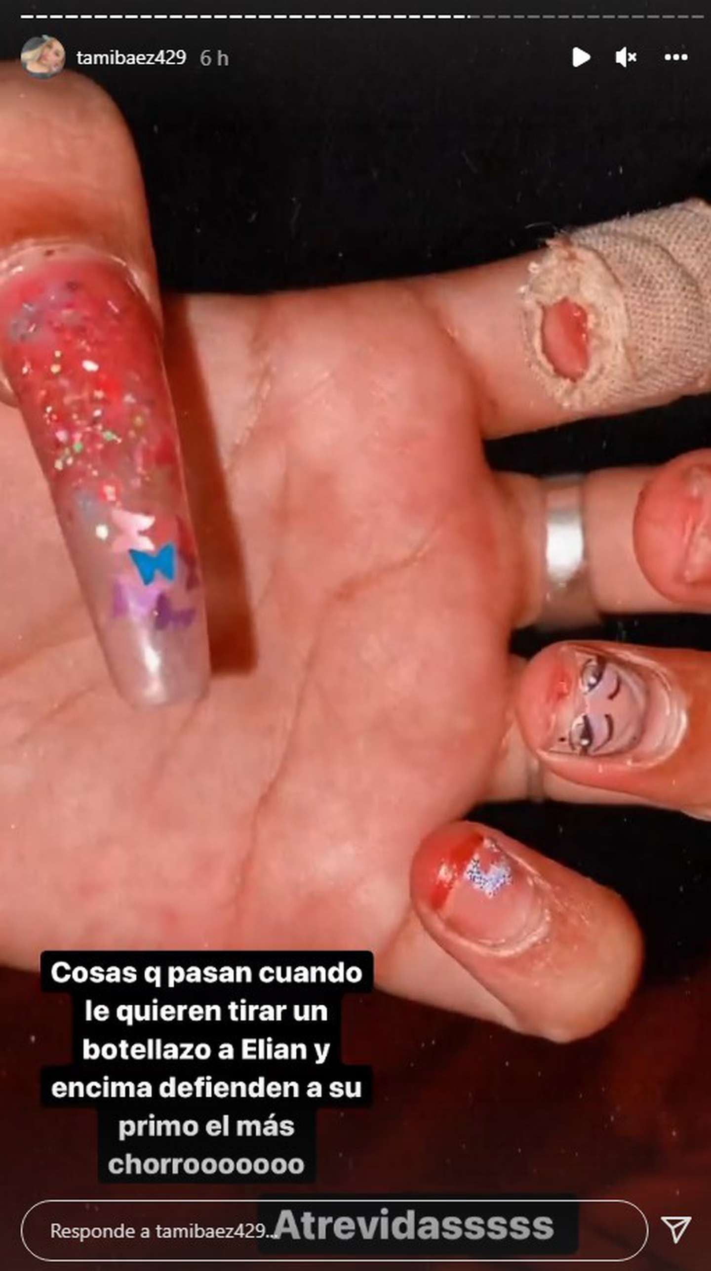 La mano de la novia de L-Gante.