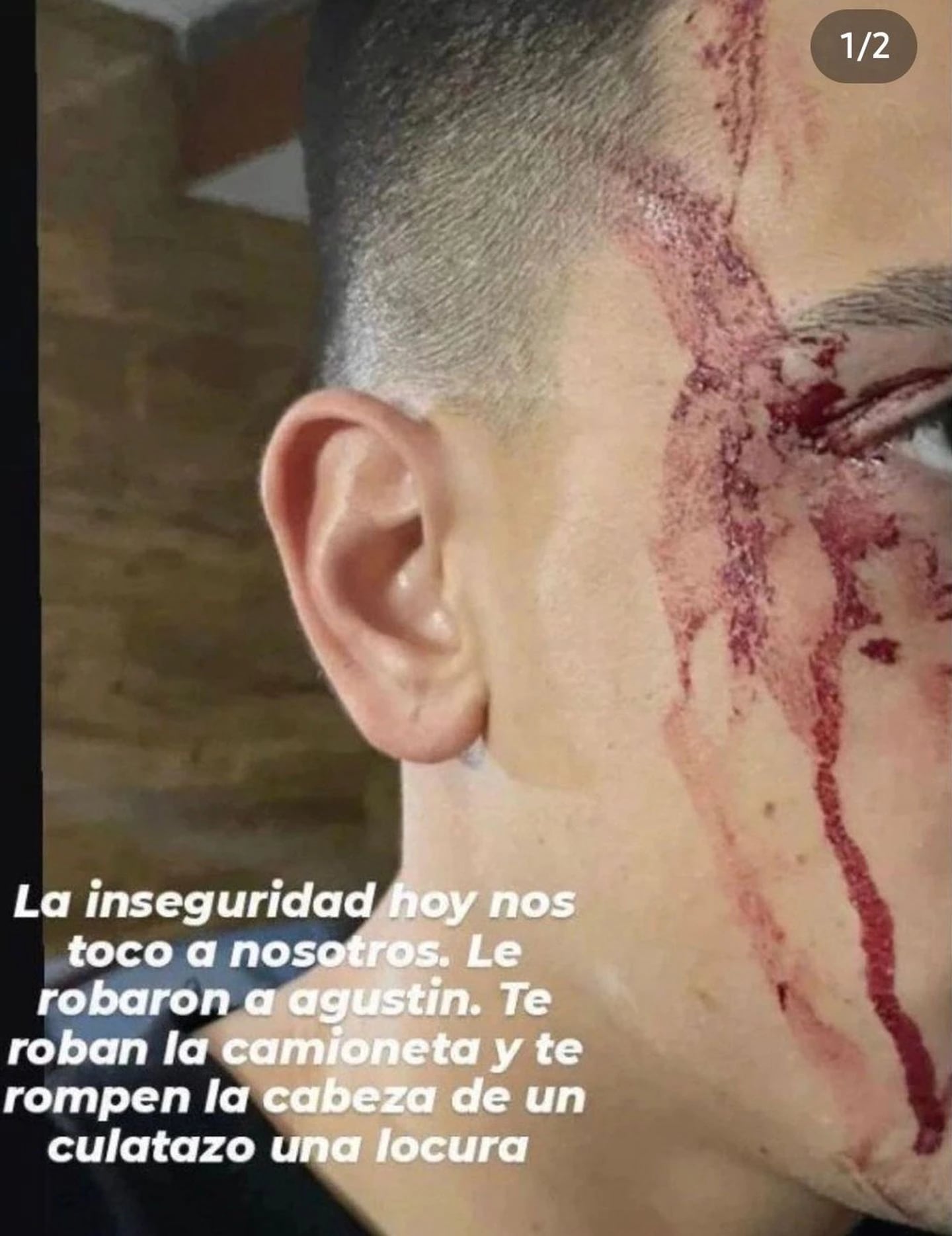 Así quedó Agustín Sández tras el robo.