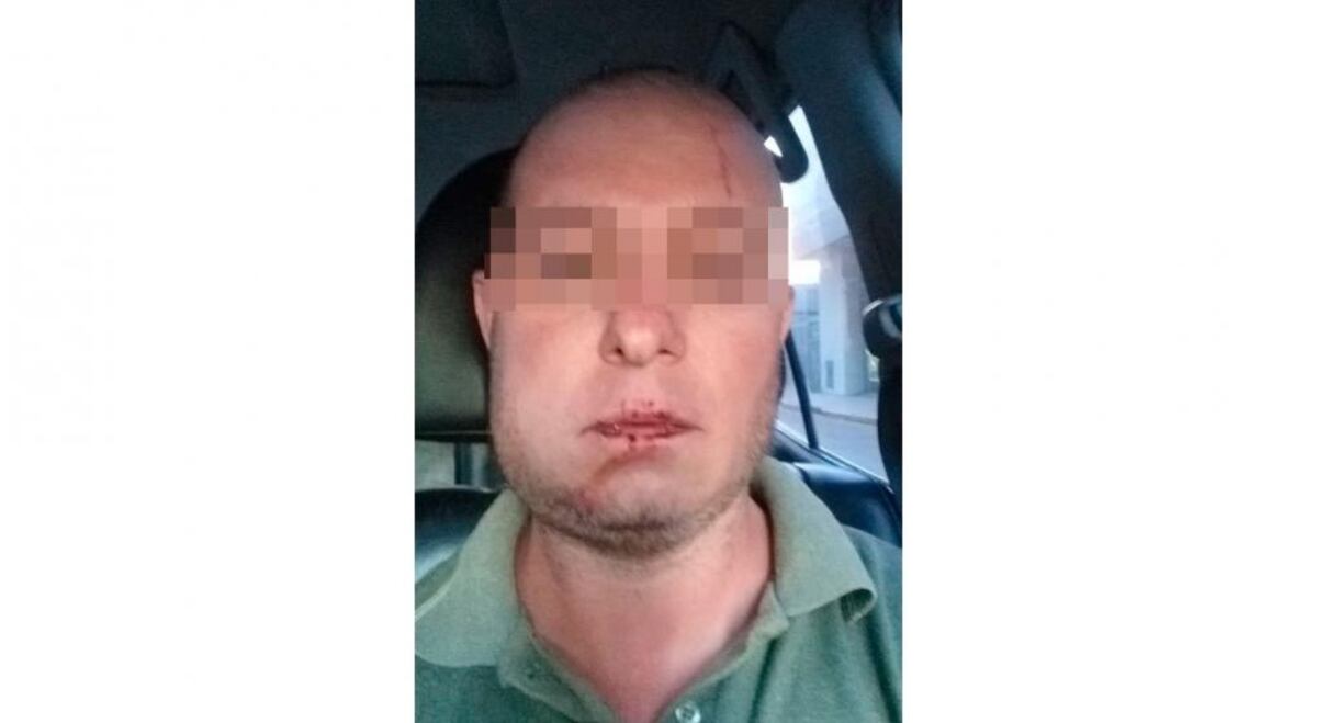 Violencia policial en Río Cuarto: piden que la figura penal sea por “lesiones gravísimas”